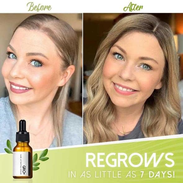 Gro+ серум за активиране на косата - Image 3