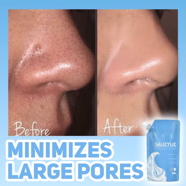 Салицилова хидро маска - Image 3