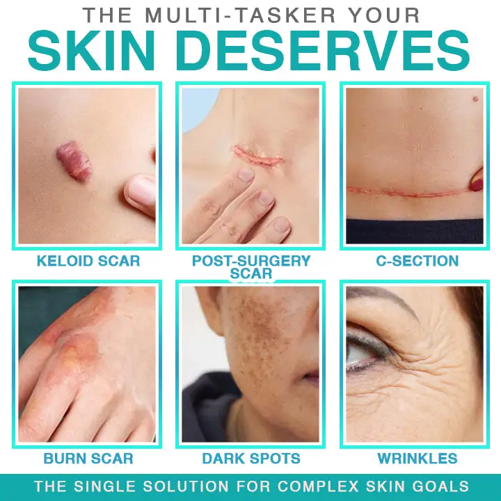 𝗖𝗮𝗿𝗲𝗕𝗿𝗲𝗲𝘇𝗲® Лепенка за грижа с микроигли 3 в 1 - Image 2