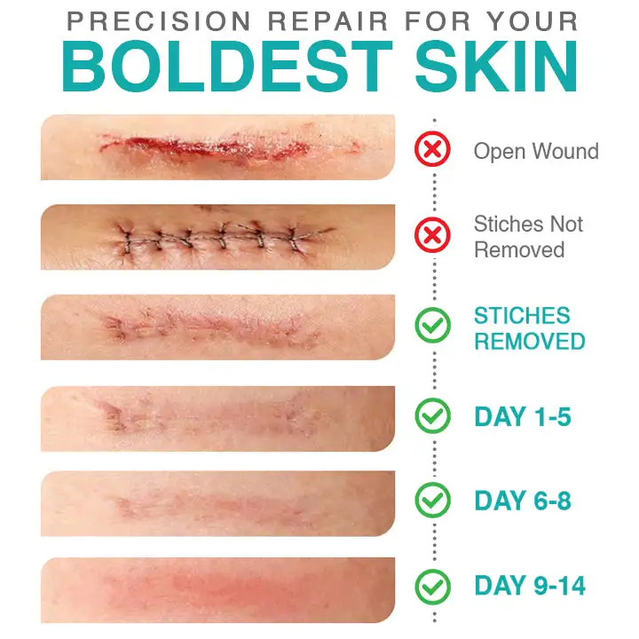 𝗖𝗮𝗿𝗲𝗕𝗿𝗲𝗲𝘇𝗲® Лепенка за грижа с микроигли 3 в 1 - Image 4