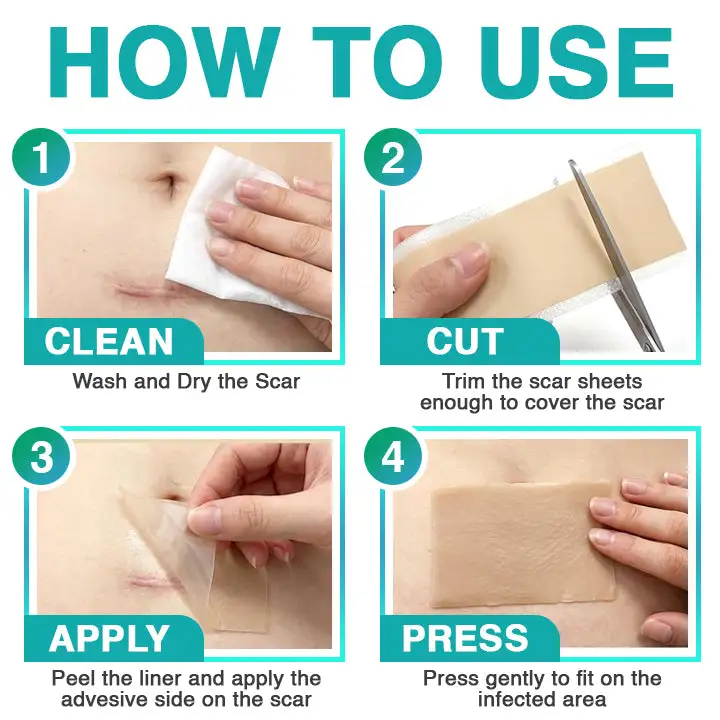 𝗖𝗮𝗿𝗲𝗕𝗿𝗲𝗲𝘇𝗲® Лепенка за грижа с микроигли 3 в 1 - Image 7