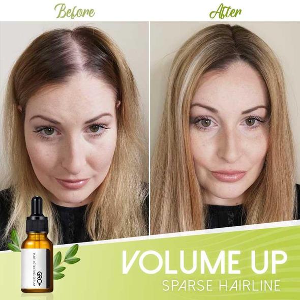 Gro+ серум за активиране на косата - Image 4