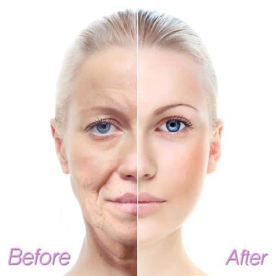 Ампулен серум - Image 4