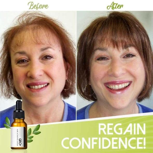 Gro+ серум за активиране на косата - Image 6