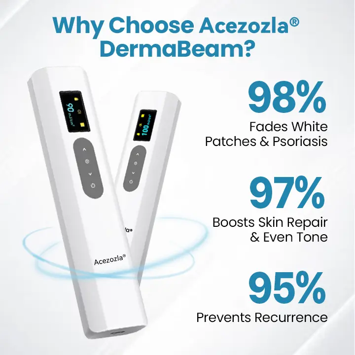 Устройство за терапия на витилиго Acezozla® DermaBeam - Image 6