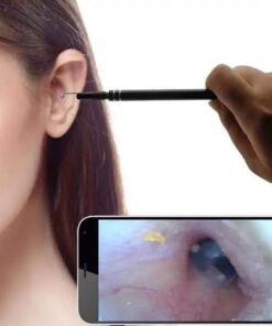 Ендоскопска камера за ухо