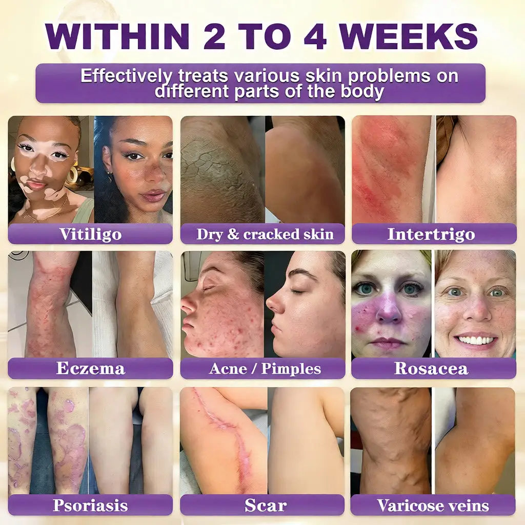 VORLORA® биотин 10-в-1 крем за възстановяване на кожата - Image 2