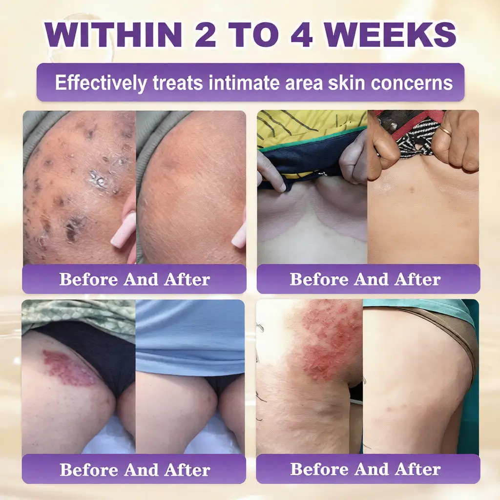 VORLORA® биотин 10-в-1 крем за възстановяване на кожата - Image 4