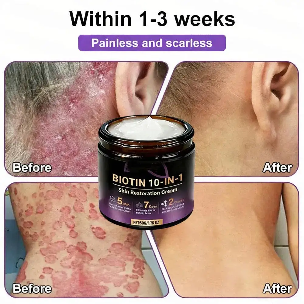 VORLORA® биотин 10-в-1 крем за възстановяване на кожата - Image 5