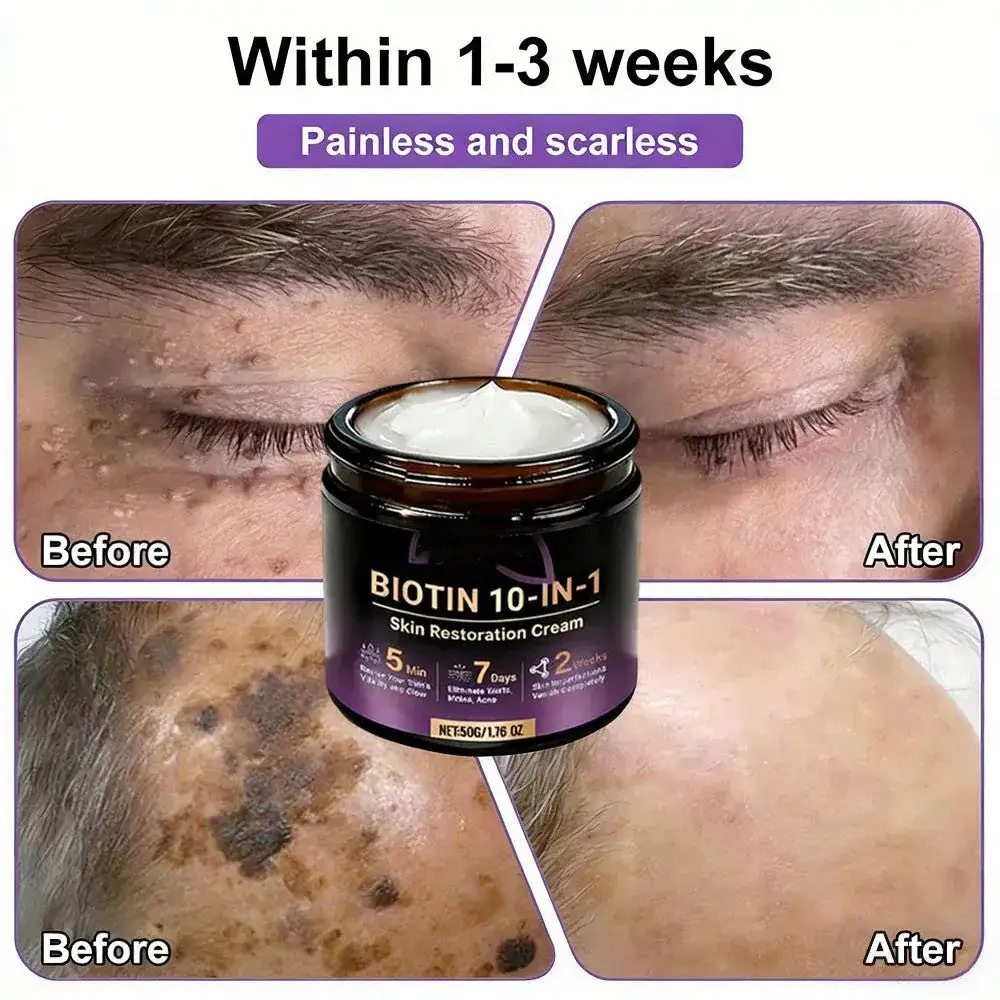 VORLORA® биотин 10-в-1 крем за възстановяване на кожата - Image 7