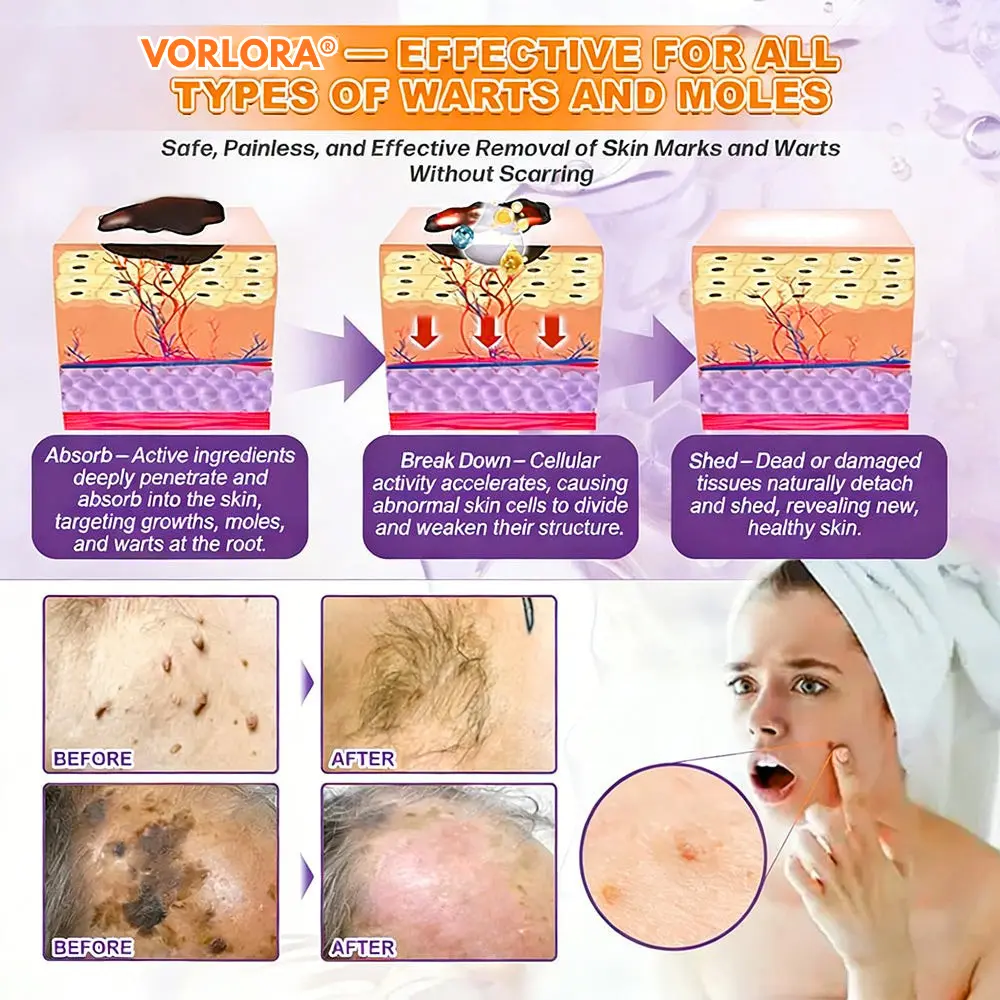 VORLORA® биотин 10-в-1 крем за възстановяване на кожата - Image 9