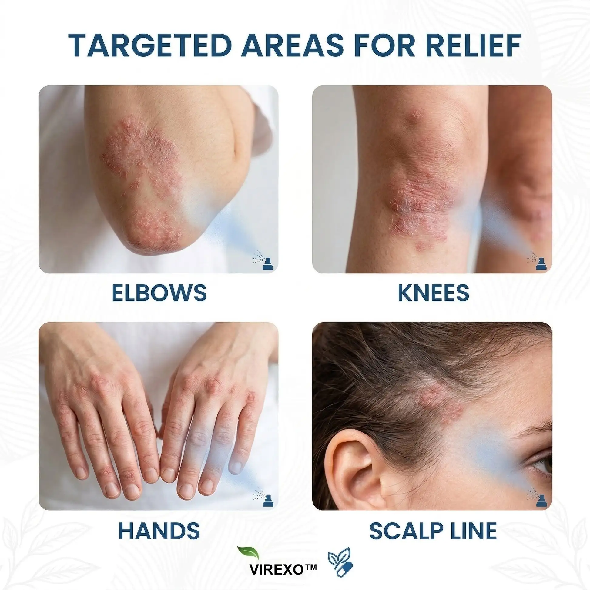 Virexo™ магнезиев ботанически спрей - Image 2