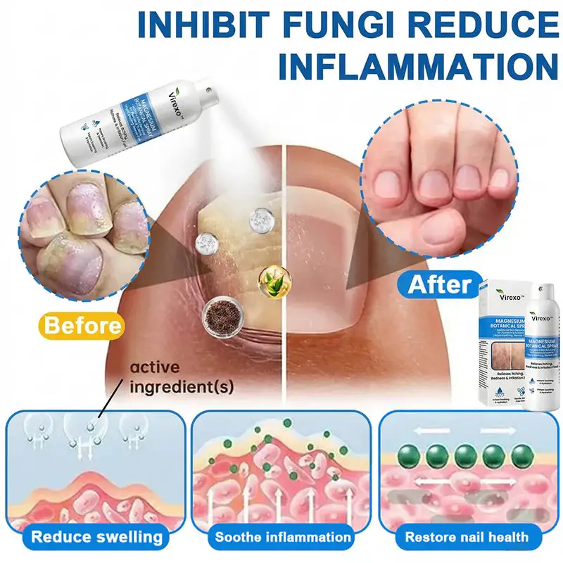 Virexo™ магнезиев ботанически спрей - Image 4