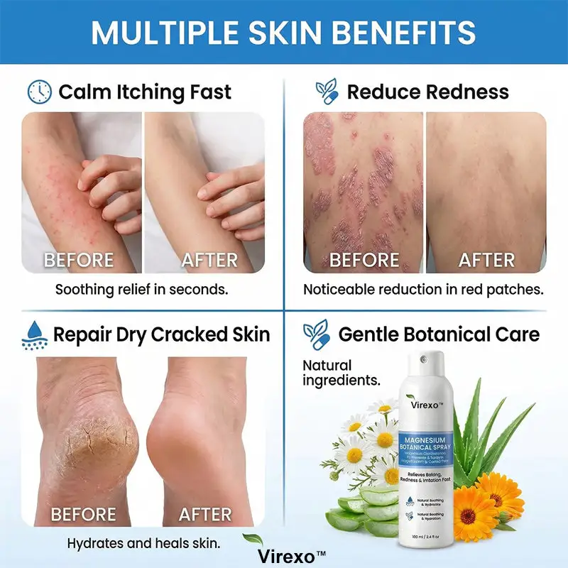 Virexo™ магнезиев ботанически спрей - Image 9